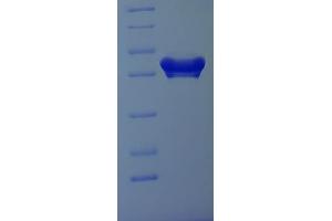 SDS-PAGE (SDS) image for MOB1, Mps One Binder Kinase Activator-Like 1B (MOBKL1B) (AA 2-216) protein (His-SUMO Tag) (ABIN5711829)