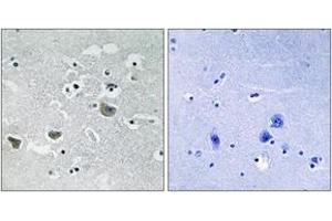 Immunohistochemistry analysis of paraffin-embedded human brain tissue, using SREBP-1 (Ab-439) Antibody. (SREBF1 抗体  (AA 405-454))