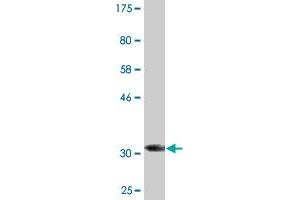Western Blotting (WB) image for anti-Potassium Inwardly-Rectifying Channel, Subfamily J, Member 5 (KCNJ5) (AA 136-204) antibody (ABIN523031)