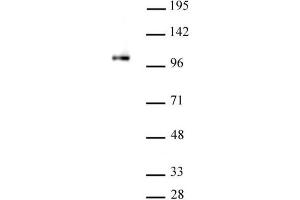 SFMBT1 antibody (pAb) tested by Western blot. (SFMBT1 抗体)