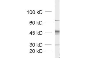 dilution: 1 : 1000, sample: crude synaptic vesicle fraction of rat brain (LP2) (Doc 2a/b (AA 1-403) 抗体)