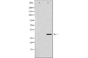 Western blot analysis of extracts of HepG2 cells, using HLA-DRB3 antibody. (HLA-DRB3 抗体)
