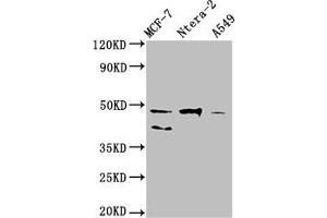 Western Blot Positive WB detected in: MCF-7 whole cell lysate, Ntera-2 whole cell lysate, A549 whole cell lysate All lanes: NANOG antibody at 1:500 Secondary Goat polyclonal to Mouse IgG at 1/10000 dilution Predicted band size: 35, 33 kDa Observed band size: 46, 40 kDa (Nanog 抗体  (AA 1-305))