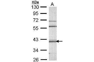 WB Image Sample (30 ug of whole cell lysate) A: Molt-4 , 10% SDS PAGE antibody diluted at 1:1000 (CAMK1D 抗体)
