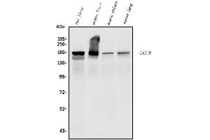 Western blot analysis of EGFR using anti-EGFR antibody (ABIN7600915).