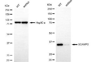 Western blotting analysis using SCAMP2 antibody (ABIN7800289). (SCAMP2 抗体)