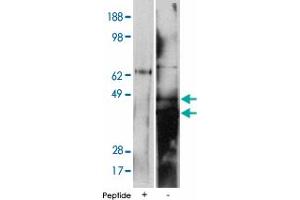 Western blot using DEGS2 polyclonal antibody on human kidney cell lysate at 15 ug/lane. (DEGS2 抗体)