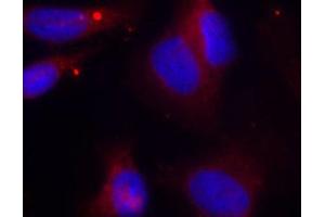 Immunofluorescence (IF) image for anti-zeta-Chain (TCR) Associated Protein Kinase 70kDa (ZAP70) (pTyr319) antibody (ABIN3023646) (ZAP70 抗体  (pTyr319))