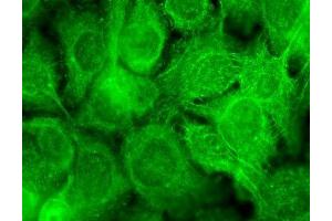 Immunocytochemistry (ICC) image for anti-Transient Receptor Potential Cation Channel, Subfamily V, Member 3 (TRPV3) (AA 458-474) antibody (Atto 594) (ABIN2485235)
