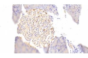 Detection of DGKz in Mouse Pancreas Tissue using Polyclonal Antibody to Diacylglycerol Kinase Zeta (DGKz) (DGKZ 抗体  (AA 657-879))