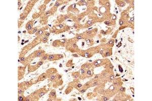 IHC analysis of FFPE human liver section using FGFR2 antibody; Ab was diluted at 1:25.