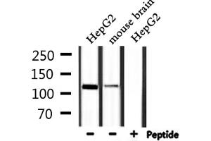 Western blot analysis of extracts from HepG2,mouse brain, using IARS2 Antibody. (IARS2 抗体  (N-Term))