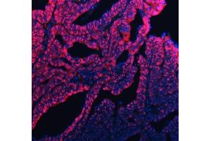 anti-Ubiquitin-Conjugating Enzyme E2M (ube2m) (AA 25-154) antibody