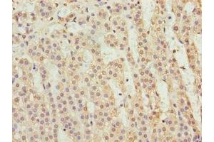 Immunohistochemistry (IHC) image for anti-Protein Phosphatase 1, Regulatory (Inhibitor) Subunit 14A (PPP1R14A) (AA 1-147), (Regulatory Subunit 14A) antibody (ABIN7165927)