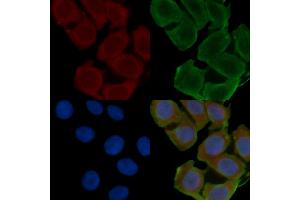 ABIN6262161 and ABIN6266557 staining Hela cells(24h of starvation treatment) by IF/ICC. (HCG beta 抗体)