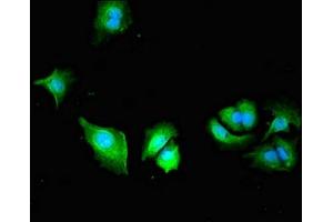 Immunofluorescent analysis of MCF-7 cells using ABIN7163564 at dilution of 1:100 and Alexa Fluor 488-congugated AffiniPure Goat Anti-Rabbit IgG(H+L) (Plastin 3 抗体  (AA 310-455))