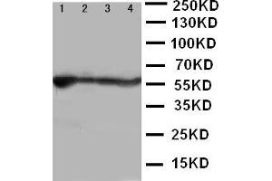 Anti-ALDH2 antibody, Western blotting Lane 1: Rat Liver Tissue Lysate Lane 2: Rat Intestine Tissue Lysate Lane 3: Rat Lung Tissue Lysate Lane 4: Rat Kidney Tissue Lysate (ALDH2 抗体  (N-Term))