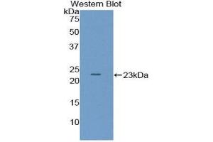 Western Blotting (WB) image for anti-Pituitary Adenylate Cyclase Activating Peptide (AA 1-175) antibody (ABIN1857915) (Pituitary Adenylate Cyclase Activating Peptide (AA 1-175) 抗体)