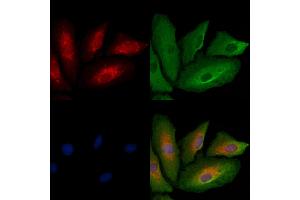 ABIN6261180 and ABIN6278834 staining  cells by IF/ICC. (COX1 抗体  (C-Term))