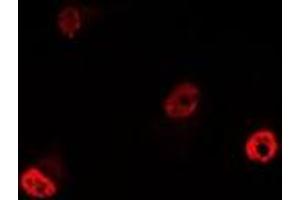 Immunofluorescent analysis of YT521-B staining in MCF7 cells. (YTHDC1 抗体)
