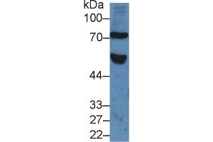 Detection of FZD1 in Human Serum using Polyclonal Antibody to Frizzled Homolog 1 (FZD1) (FZD1 抗体  (AA 117-322))