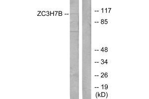 Western blot analysis of extracts from 293 cells, using ZC3H7B antibody. (ZC3H7B 抗体  (C-Term))