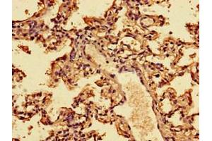 Immunohistochemistry of paraffin-embedded human lung tissue using ABIN7156561 at dilution of 1:100 (IFNA2 抗体  (AA 24-188))
