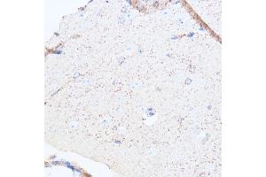 Immunohistochemistry of paraffin-embedded mouse brain using Monoamine Oxidase A (Monoamine Oxidase A (MAOA)) antibody (ABIN3021915, ABIN3021916, ABIN3021917 and ABIN6217576) at dilution of 1:100 (40x lens).