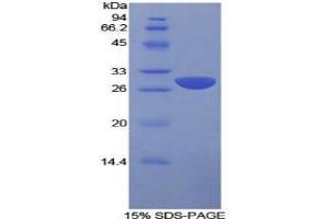 SDS-PAGE analysis of Human SLAMF1 Protein. (SLAMF1 蛋白)