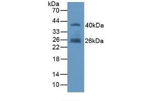 Detection of Recombinant FAPa, Human using Polyclonal Antibody to Fibroblast Activation Protein Alpha (FAPa) (FAP 抗体  (AA 523-760))