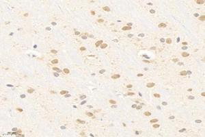 Immunohistochemistry analysis of paraffin-embedded rat brain using,SMAD9 (ABIN7075625) at dilution of 1: 800 (SMAD9 抗体)