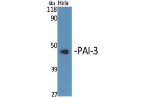 Western Blotting (WB) image for anti-serpin Peptidase Inhibitor, Clade A (Alpha-1 Antiproteinase, Antitrypsin), Member 5 (SERPINA5) (Internal Region) antibody (ABIN6282428)