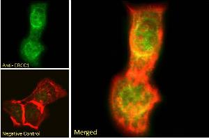 ABIN6391360 Immunofluorescence analysis of paraformaldehyde fixed A431 cells, permeabilized with 0. (ERCC1 抗体  (Internal Region))