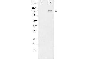 Western blot analysis of HER2 phosphorylation expression in EGF treated MDA-MB-231 whole cell lysates,The lane on the left is treated with the antigen-specific peptide. (ErbB2/Her2 抗体  (pTyr877))