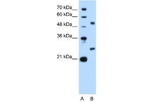 WB Suggested Anti-BCL2L1 Antibody Titration: 2. (BCL2L1 抗体  (N-Term))