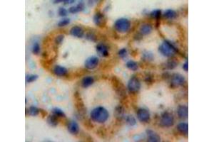 IHC-P analysis of Liver tissue, with DAB staining. (NOD1 抗体  (AA 612-826))