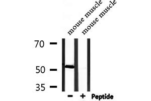 Western Blotting (WB) image for anti-Inositol Hexakisphosphate Kinase 3 (IP6K3) (Internal Region) antibody (ABIN6258488)