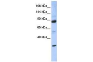 Image no. 1 for anti-Zinc Fingers and Homeoboxes 3 (ZHX3) (AA 864-913) antibody (ABIN6744228) (ZHX3 抗体  (AA 864-913))