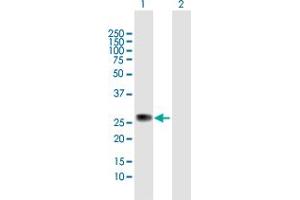 Western Blot analysis of ZC4H2 expression in transfected 293T cell line by ZC4H2 MaxPab polyclonal antibody. (ZC4H2 抗体  (AA 1-224))