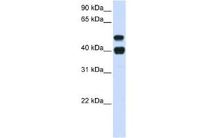 USP22 antibody used at 1 ug/ml to detect target protein. (USP22 抗体  (N-Term))