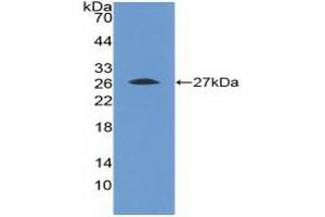 Detection of Recombinant FGFR4, Human using Polyclonal Antibody to Fibroblast Growth Factor Receptor 4 (FGFR4) (FGFR4 抗体  (AA 168-369))