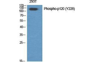 Western Blot (WB) analysis of specific cells using Phospho-p120 (Y228) Polyclonal Antibody. (CTNND1 抗体  (pTyr228))