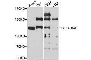 Western blot analysis of extracts of various cell lines, using CLEC16A antibody (ABIN5996330) at 1/1000 dilution. (CLEC16A 抗体)