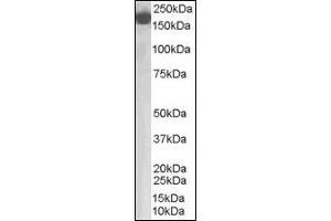 Image no. 2 for anti-Complement Factor H (CFH) (Internal Region) antibody (ABIN372860) (Complement Factor H 抗体  (Internal Region))