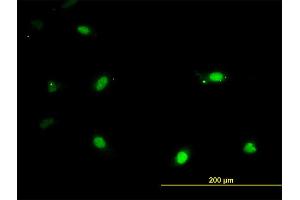 Immunofluorescence of monoclonal antibody to IRX3 on HeLa cell. (IRX3 抗体  (AA 182-285))