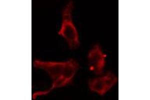 ABIN6274579 staining Hela cells by IF/ICC. (ADCY4 抗体  (Internal Region))