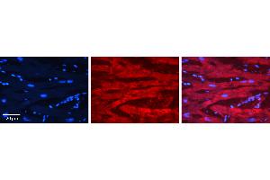 Rabbit Anti-EWSR1 Antibody   Formalin Fixed Paraffin Embedded Tissue: Human heart Tissue Observed Staining: Cytoplasmic, plasma membrane Primary Antibody Concentration: 1:100 Other Working Concentrations: 1:600 Secondary Antibody: Donkey anti-Rabbit-Cy3 Secondary Antibody Concentration: 1:200 Magnification: 20X Exposure Time: 0. (EWSR1 抗体  (Middle Region))