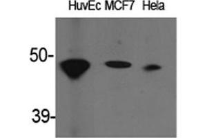 Western Blot (WB) analysis of specific cells using ACAT-1 Polyclonal Antibody. (SOAT1 抗体  (Internal Region))