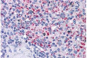 Human Spleen: Formalin-Fixed, Paraffin-Embedded (FFPE) (Integrin beta 3 抗体)
