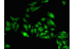 Immunofluorescent analysis of Hela cells using ABIN7169412 at dilution of 1:100 and Alexa Fluor 488-congugated AffiniPure Goat Anti-Rabbit IgG(H+L) (SETD5 抗体  (AA 519-700))